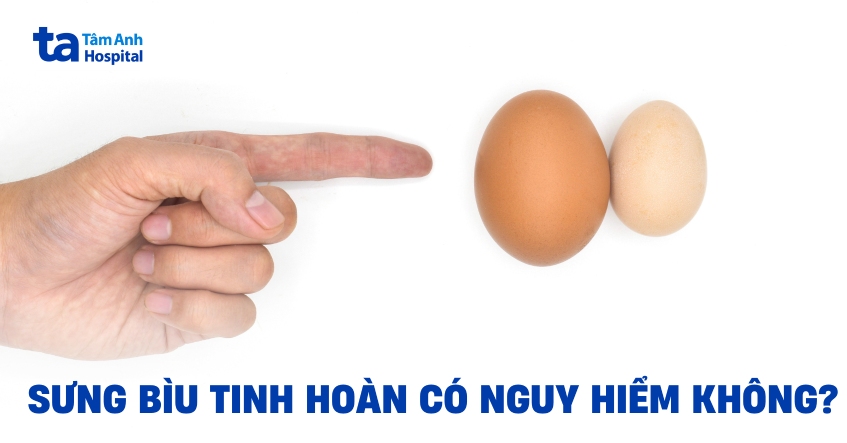 Cảnh giác với sưng bìu tinh hoàn và hướng xử lý