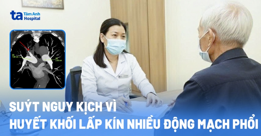 Suýt nguy kịch vì huyết khối lấp kín nhiều động mạch phổi