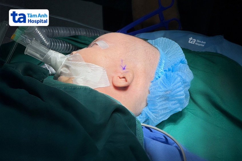 tai của bé thành trước phẫu thuật