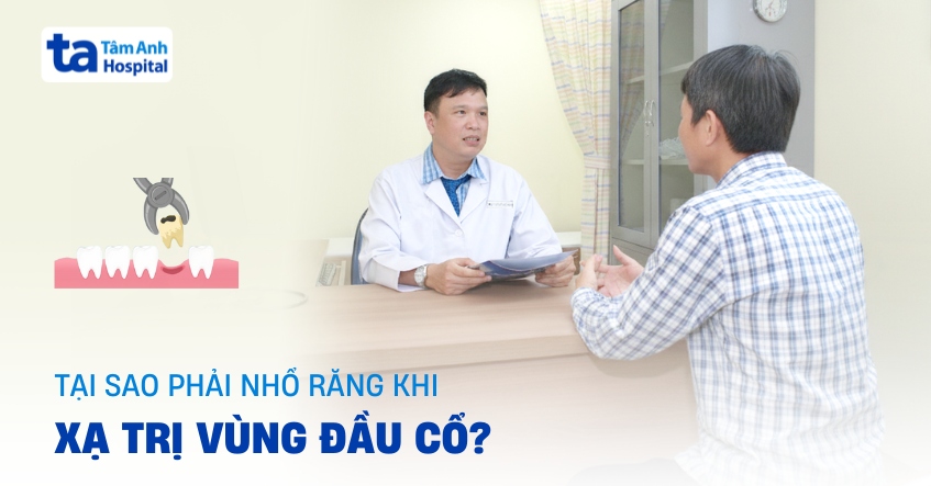 Tại sao phải nhổ răng khi xạ trị vùng đầu cổ? Có cần thiết?