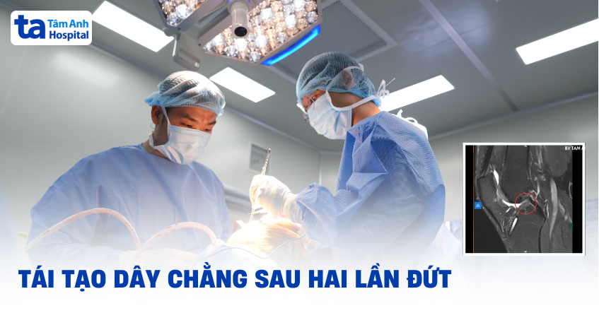 Tái tạo dây chằng sau hai lần đứt