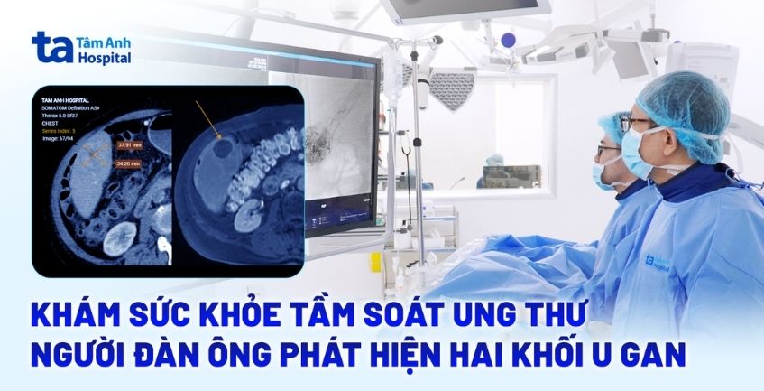 Khám sức khỏe tầm soát ung thư, người đàn ông phát hiện hai khối u gan