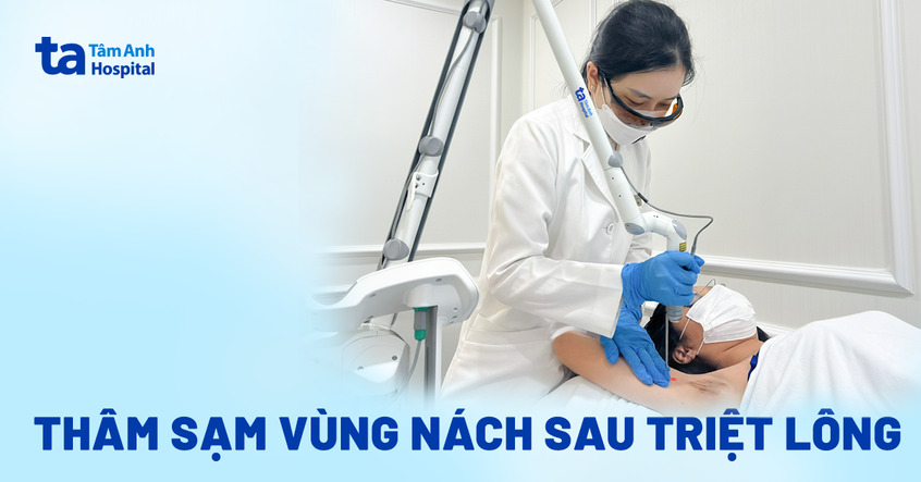 Thâm sạm vùng nách sau triệt lông