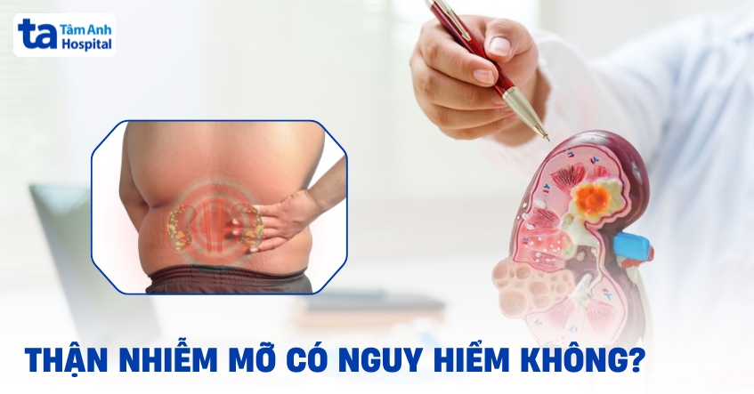 Thận nhiễm mỡ là gì? Những nguy cơ khôn lường