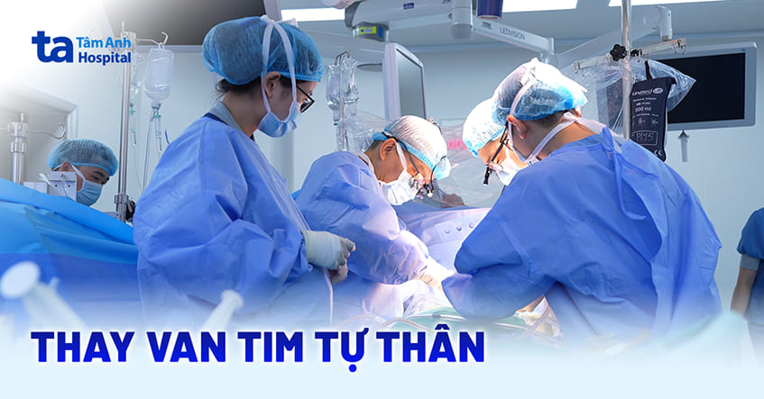 Thay van tim tự thân là gì? Có bao nhiêu phương pháp hiện nay?