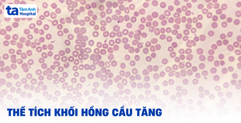 Thể tích khối hồng cầu tăng: Nguyên nhân, triệu chứng và điều trị