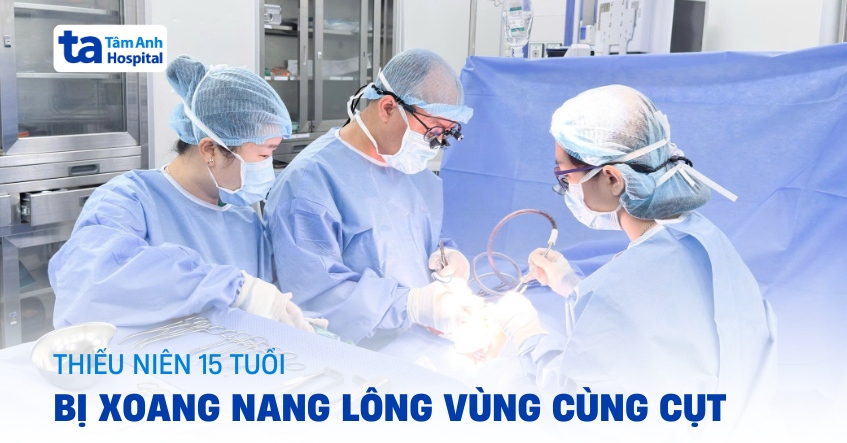 Thiếu niên 15 tuổi bị xoang nang lông vùng cùng cụt