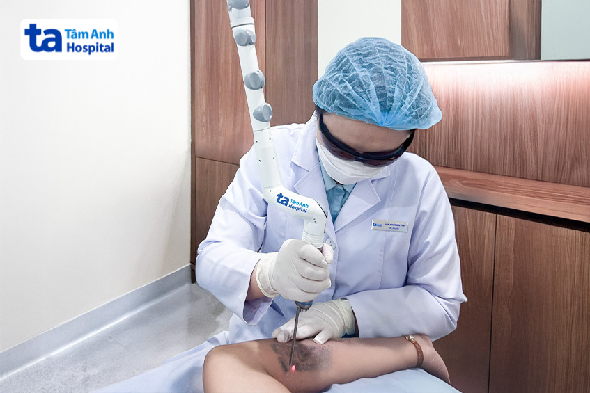 thời gian cần bôi thuốc sau khi xóa xăm