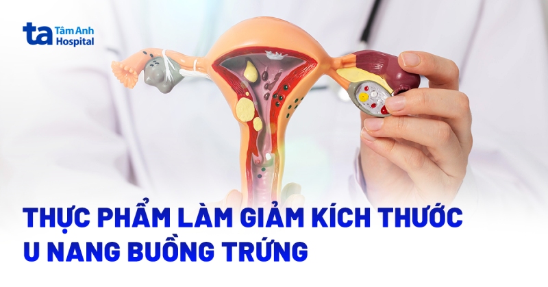 7 thực phẩm làm giảm kích thước u nang buồng trứng bạn nên ăn