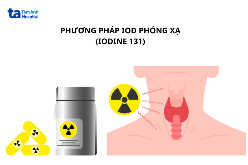 thuốc i-ốt phóng xạ được dùng trong điều trị cường giáp