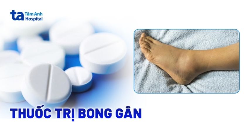 Khi nào cần dùng thuốc trị bong gân và loại nào hiệu quả?