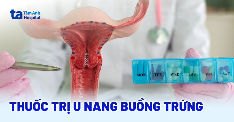 Chọn loại thuốc trị u nang buồng trứng nào tốt và phù hợp?