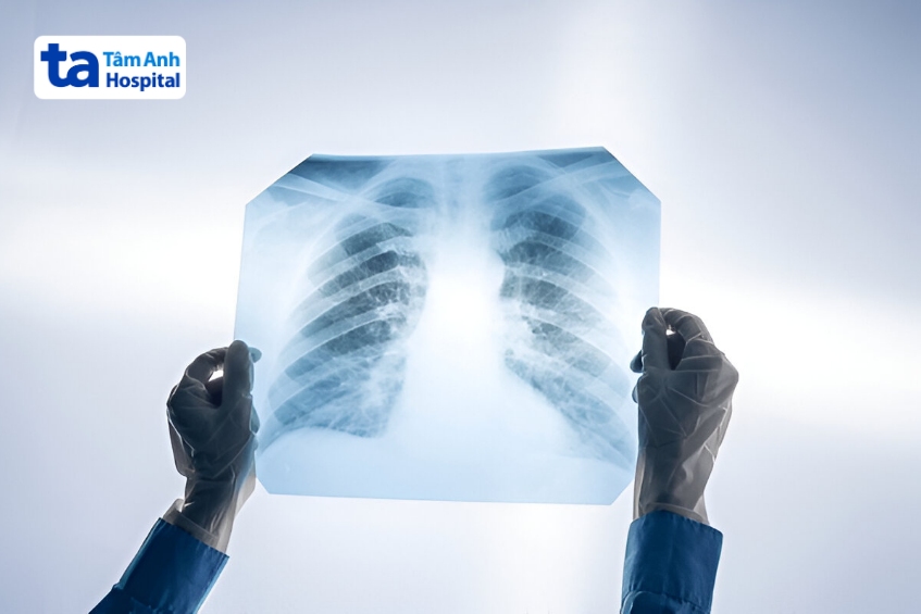 tia X giúp phát hiện ung thư