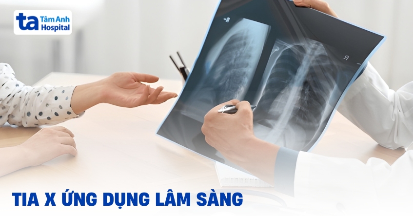 Tia X là gì? Ứng dụng lâm sàng, lợi ích trong đời sống