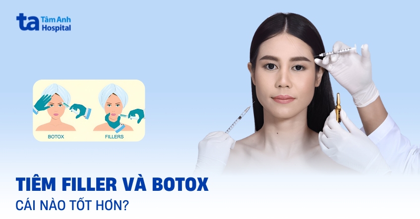 Tiêm botox và tiêm filler khác nhau như thế nào?