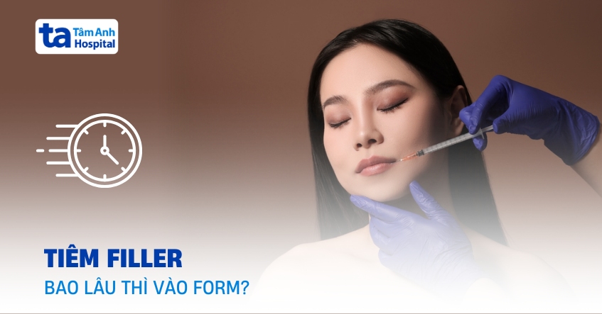 Sau khi tiêm filler bao lâu thì vào form và bắt đầu mềm đẹp?