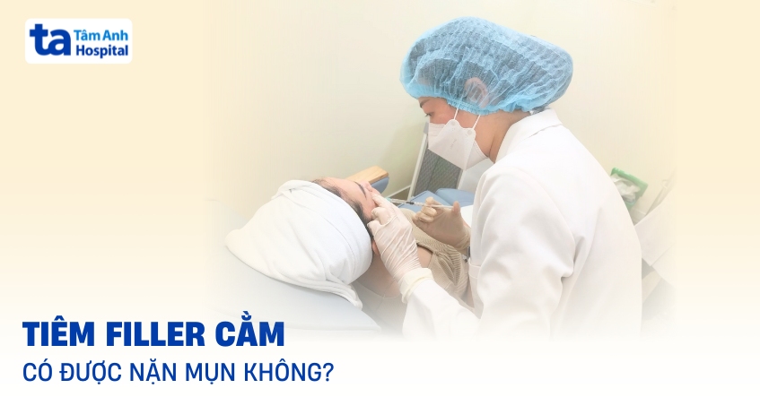 Giải đáp: Tiêm filler cằm có nặn mụn được không?