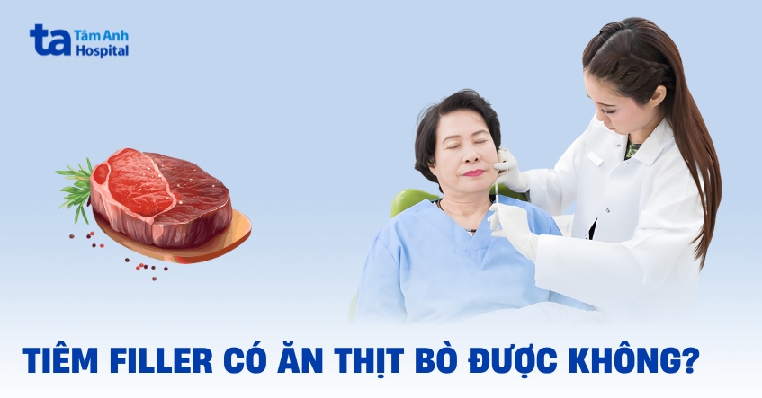 Giải đáp nhanh: Tiêm filler có được ăn thịt bò không?