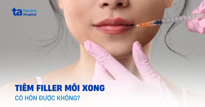 Giải đáp: Tiêm filler môi xong có hôn được không?