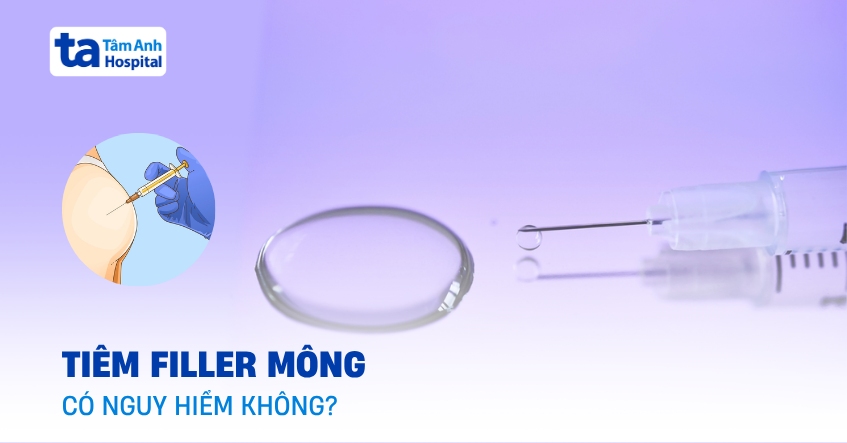 Tiêm filler mông vì sao không được cấp phép?