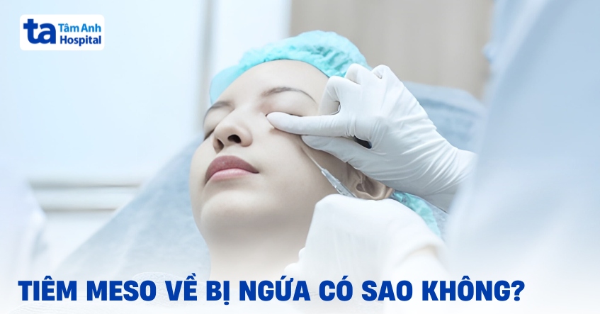 Tiêm meso bị ngứa có đáng lo ngại không?