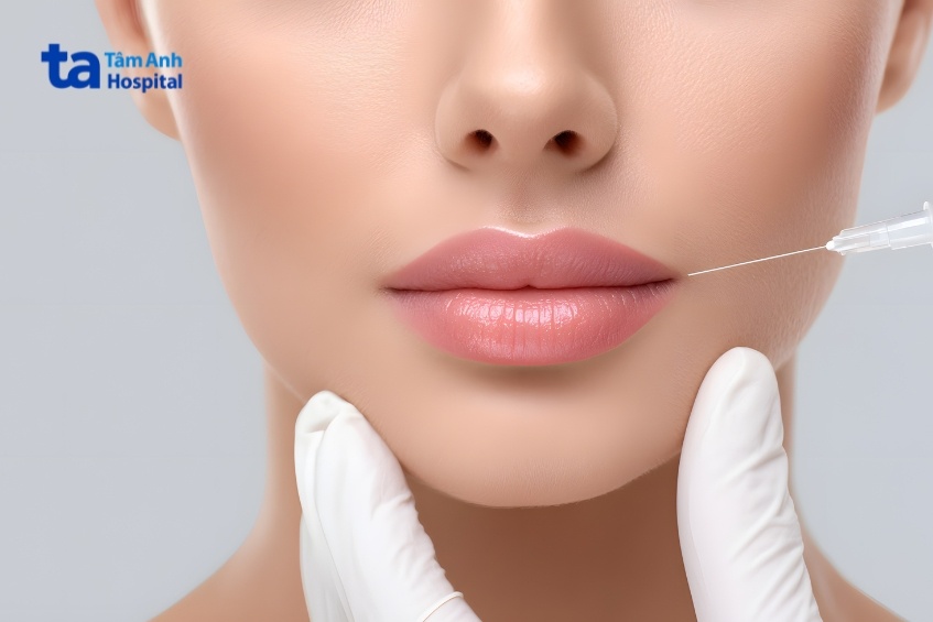 tiêm môi trái tim là gì