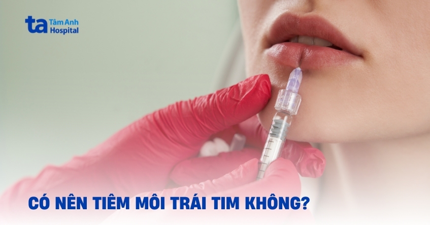 Tiêm môi trái tim sao cho tự nhiên và đẹp nhất?