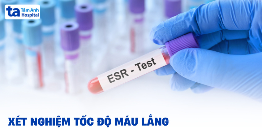 Xét nghiệm tốc độ máu lắng là gì? Phương pháp và cách hiểu kết quả
