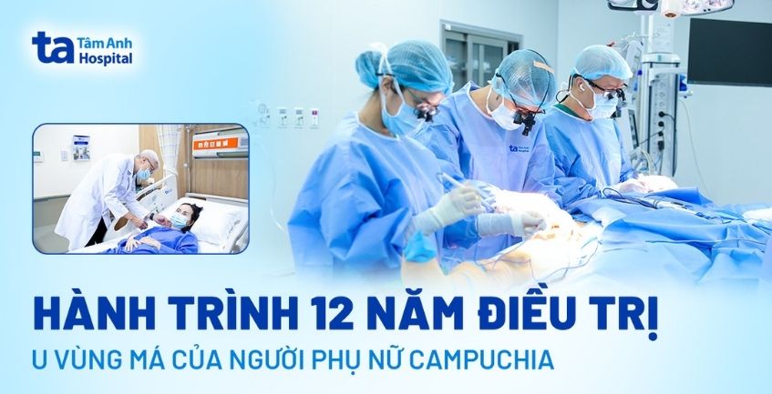 Hành trình 12 năm điều trị u vùng má của người phụ nữ Campuchia