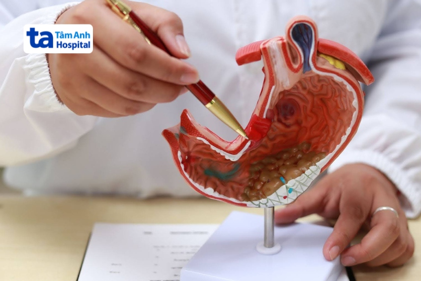 trong điều trị ung thư dạ dày, phẫu thuật và hóa trị là lựa chọn chính. xạ trị chỉ được cân nhắc ở một số trường hợp nhất định