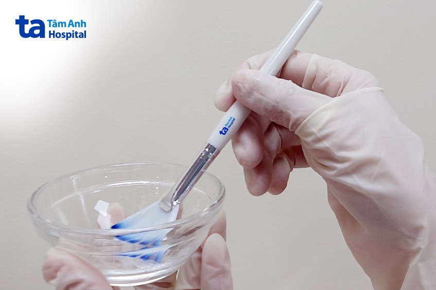 tùy vào nồng độ peel mà da bị ảnh hưởng