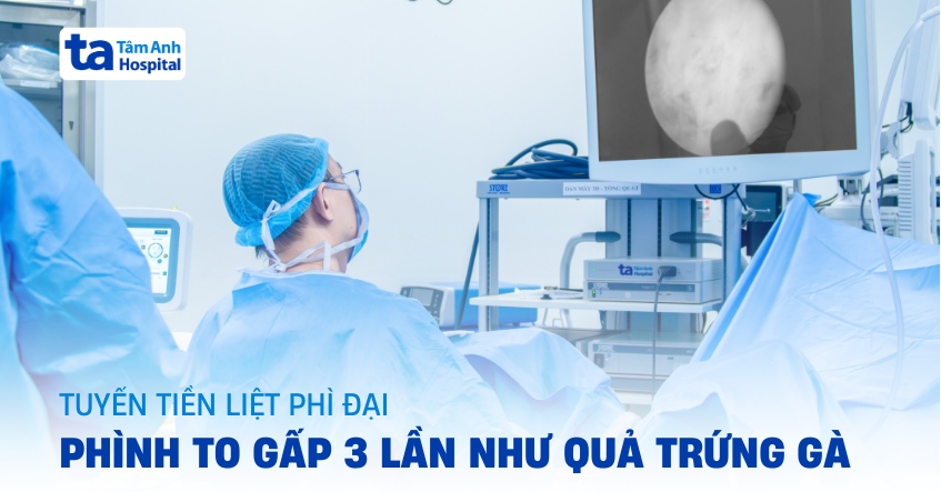 Tuyến tiền liệt phì đại phình to 3 lần như quả trứng gà