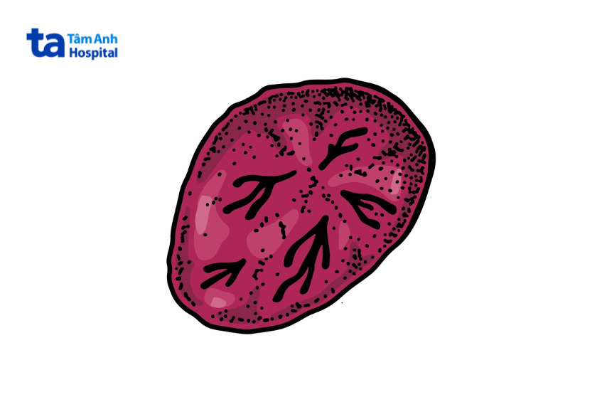 tỷ lệ hồng cầu reticulocyte bình thường trong máu