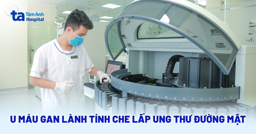 U máu gan lành tính che lấp ung thư đường mật