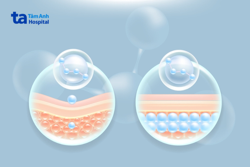 ứng dụng của filler trong thẩm mỹ