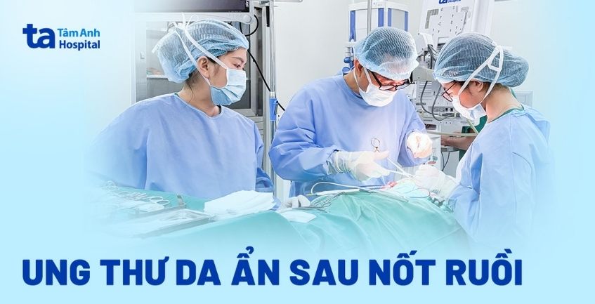 Ung thư da ẩn sau nốt ruồi