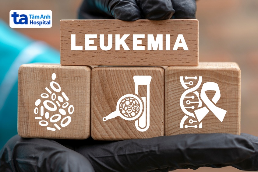 ung thư máu thể bạch cầu là ung thư tủy xương và máu, do tăng sinh bất thường bạch cầu chưa trưởng thành