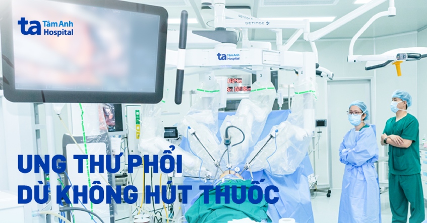 Ung thư phổi dù không hút thuốc