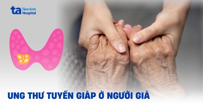 Nguy cơ mắc ung thư tuyến giáp ở người già có cao không?