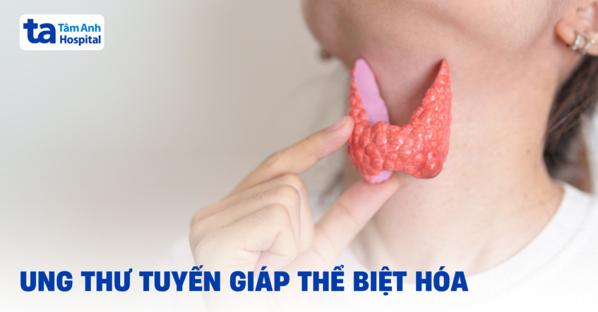 Các loại ung thư tuyến giáp thể biệt hóa