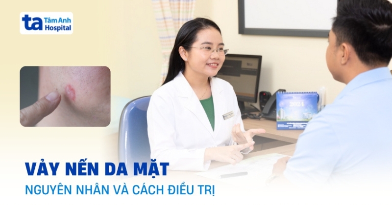 Tìm hiểu về vảy nến da mặt cùng hướng xử trí nhanh