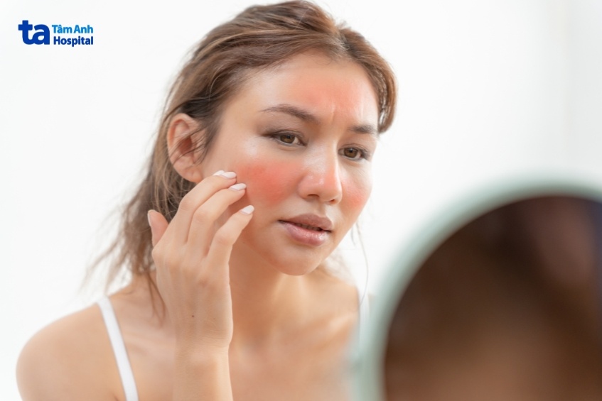 vì sao bị cháy tê