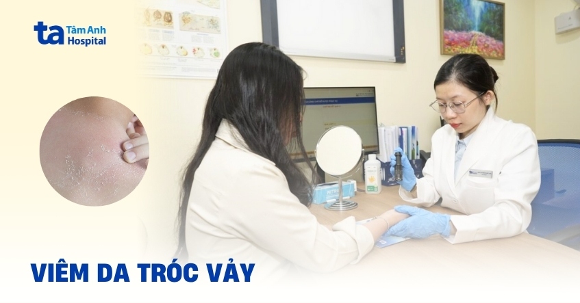 Viêm da bong vảy: Nhận biết để điều trị và phòng ngừa sớm