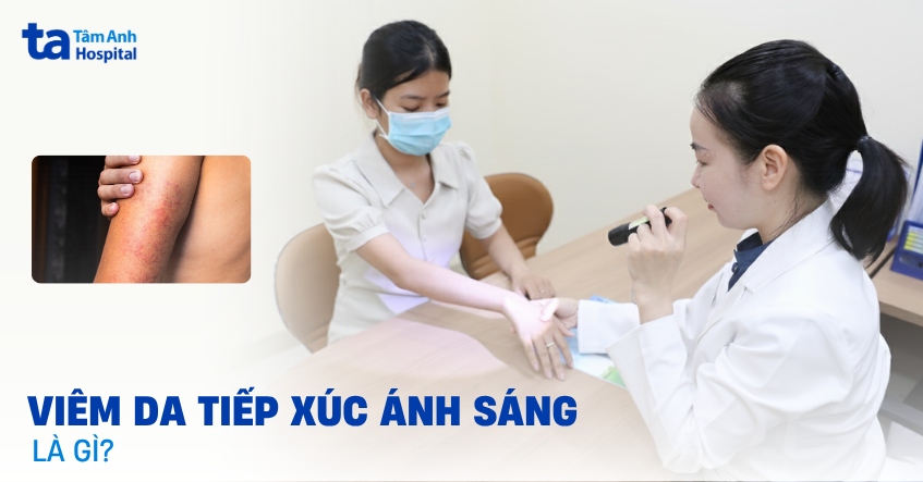 Tìm hiểu về viêm da tiếp xúc ánh sáng