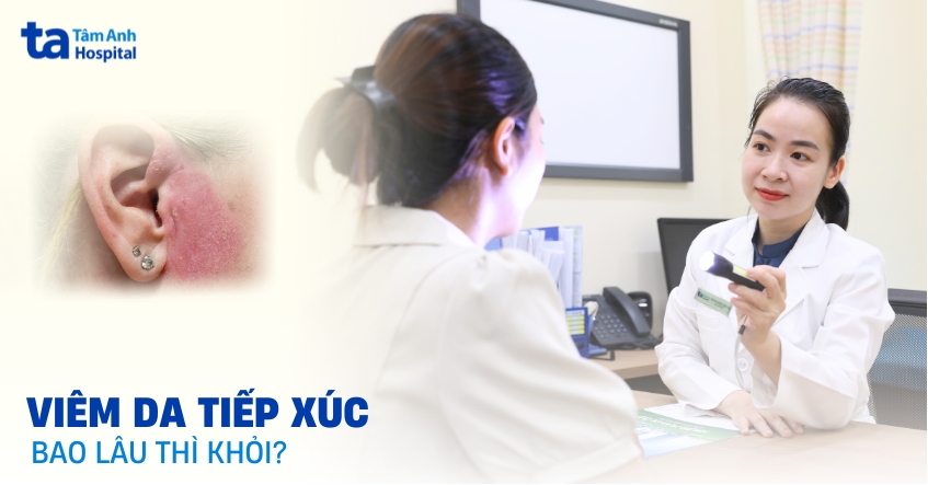 Giải đáp thắc mắc: Viêm da tiếp xúc bao lâu thì khỏi?