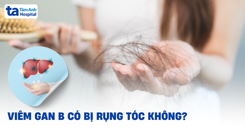 Nếu mắc viêm gan B có bị rụng tóc không?