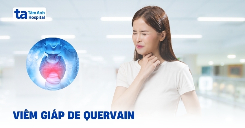 Tìm hiểu thông tin về viêm giáp De Quervain