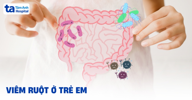 Viêm ruột ở trẻ em: Nguyên nhân, triệu chứng và điều trị