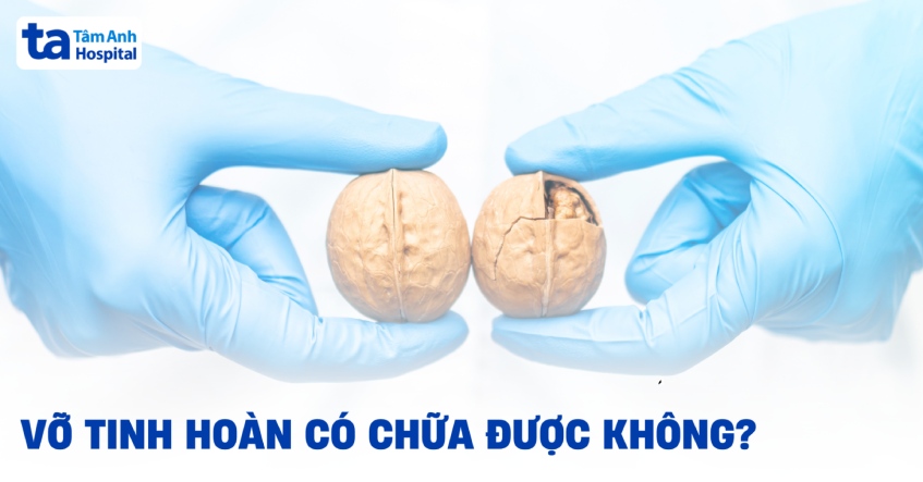 Vỡ tinh hoàn có chữa được không? 3 cách điều trị hiệu quả