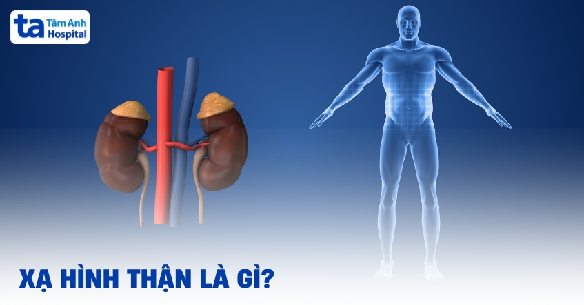 Chụp xạ hình thận có chống chỉ định ra sao?